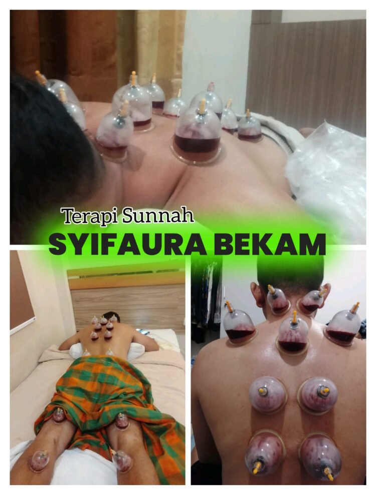SYIFAURA BEKAM,Terapi Sunnah Untuk kesehatan di Kota Pekanbaru 